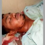 নবীনগরে চাপাতি হামলায় আহত যুবক মোশাররফ হোসেন