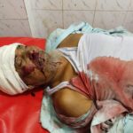 লালপুরে অটোরিকশার ধাক্কায় নিহত বৃদ্ধ মোস্তফা হোসেনের ঘটনায় ঘটনাস্থলের দৃশ্য